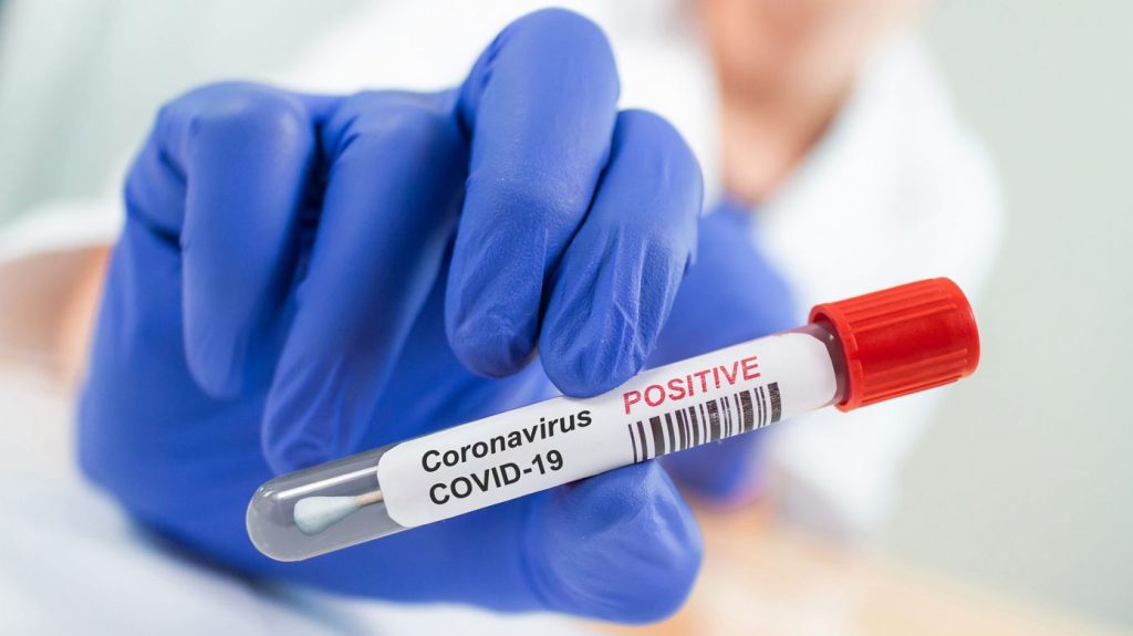 Coronavirus Test 